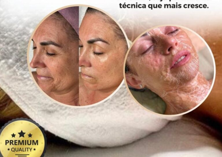 Enzima Botox Pavanelo com Certificado
