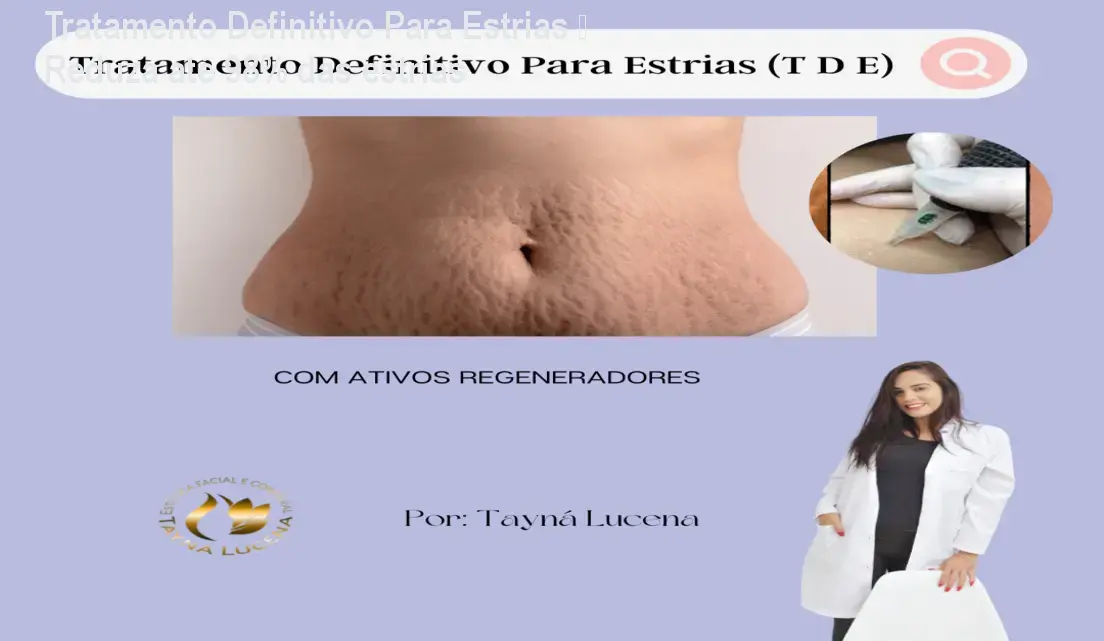 Imagem mostrando a aplicação da técnica de permeabilização dérmica do curso Tratamento Definitivo Para Estrias para redução de estrias