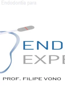 Método VONO – Curso de Endodontia para Canais Complexos