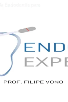 Método VONO – Curso de Endodontia para Canais Complexos