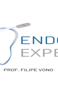 Método VONO – Curso de Endodontia com Kit de Limas Inclusas
