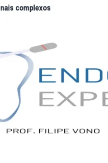 Método VONO: Domine canais complexos com kit exclusivo