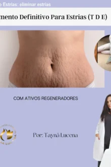 Tratamento Estrias: eliminar estrias visíveis – Preço