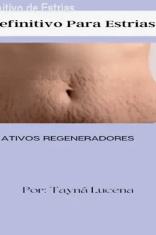 Curso Tratamento Definitivo de Estrias – Reduza Marcas