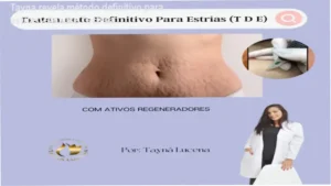 Tayna de Lucena Silva revela bastidores do Método TDE para estrias em análise técnica detalhada
