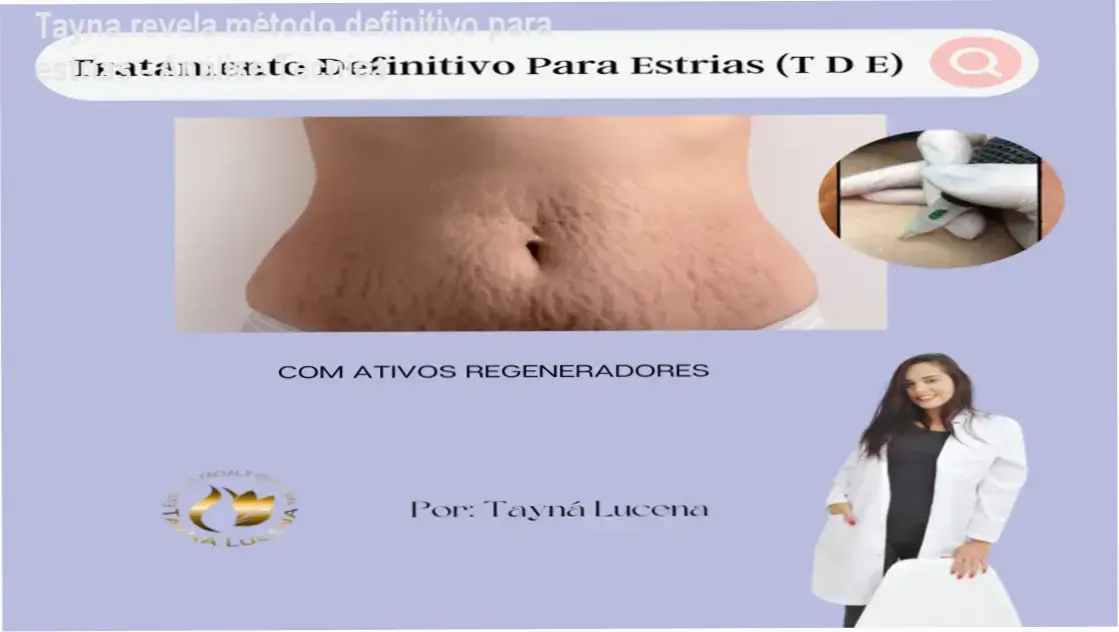 Tayna de Lucena Silva revela bastidores do Método TDE para estrias em análise técnica detalhada