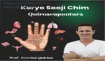 Aplicação da técnica de Quiropuntura Koryo Sooji Chim através da estimulação de pontos reflexológicos nas mãos