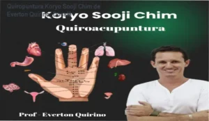 Aplicação da técnica de Quiropuntura Koryo Sooji Chim através da estimulação de pontos reflexológicos nas mãos
