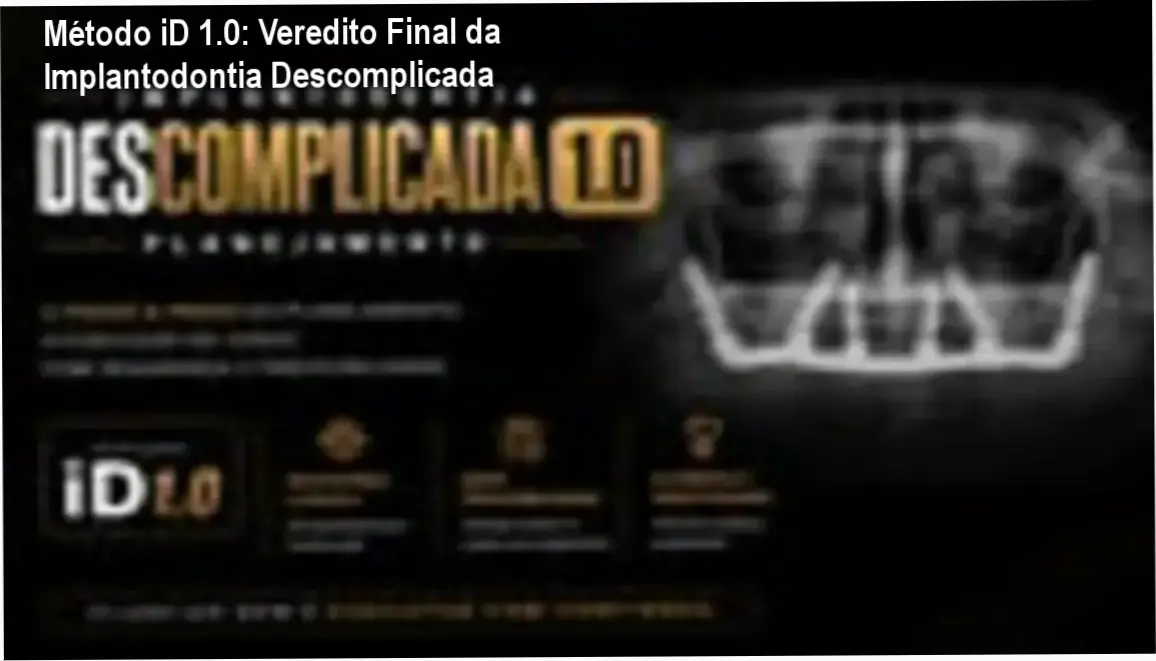 Detalhes do curso Método iD 1.0 de Implantodontia Descomplicada do Dr. Leonardo Lafuente
