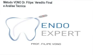Kit de limas do Método VONO e material de instrumentação endodôntica do Dr. Filipe